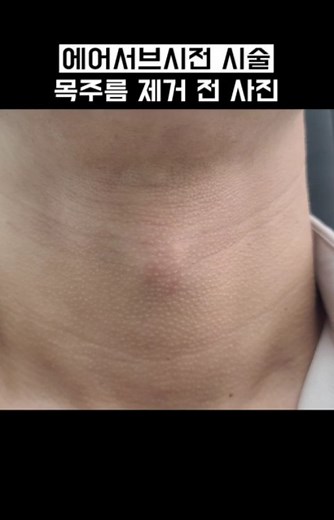 청담솔루션의원 | 🌸솔루션클리닉 진료안내🌸⠀ 월,목 10:00 ~ 19:00 ⠀ 화,금 10:00 ~ 20:00 ⠀ 점심시간 13:00 ~ 14:00 ⠀ 토요일 09:00 ~ 15:00⠀ 공휴일, 일요일 휴진 ✔️ 📞... | Instagram