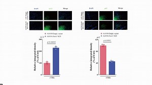 20240402-四川大学雷鹏-微管相关蛋白DANALI参与tau诱导的退行性疾病的分子机制_哔哩哔哩_bilibili