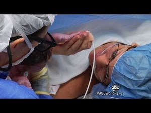 Miracle Baby: Heart Surgery Before Birth Saves Baby's Life