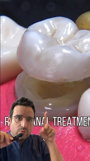 Les ETAPES de la DEVITALISATION et Endocouronne