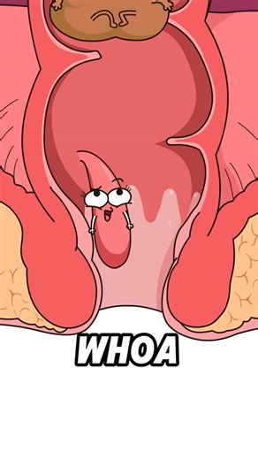 Iron Doctor on Instagram: "Hemorrhoid Getting Followed? #Hemorrhoids#RubberBandLigation#HemorrhoidSymptoms#MinimallyInvasiveSurgery #ColorectalHealth #MedicalExplainer"
