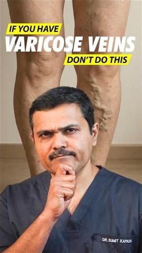 If You Have Varicose Veins, STOP Doing This Immediately ⚠️