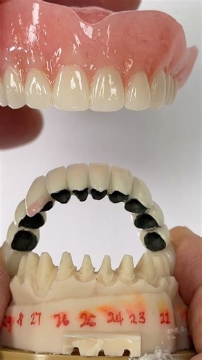 71K views · 191 reactions | Denture and PFM Bridge! @_etec_ | CEO Luke Kahng | Facebook