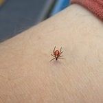 Tick Removal - Cooperative Extension: Tick Lab - University of Maine Cooperative Extension