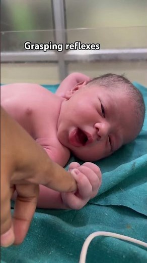Newborn Baby Grasping Reflex 👶✋ | Palmar Grasp Reflex Explained #shorts #shortsfeed #viralvideo