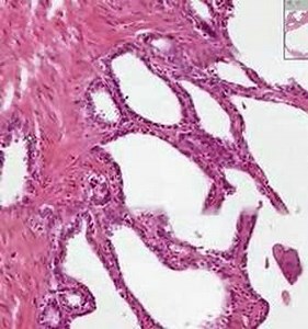 Shotgun Histology Seminal Vesicles