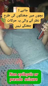 4 comments | Non epileptic, functional or pseudo seizures | Dr. Arshad Mehmood - Child Specialist | Facebook