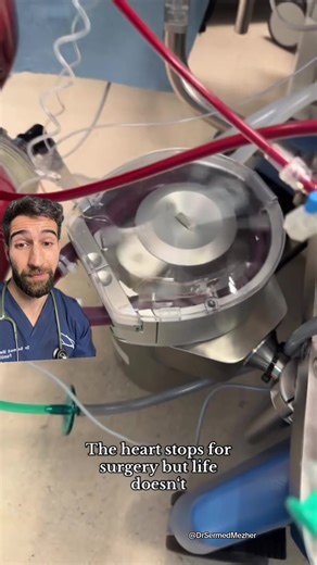 POV: You Get Heart Surgery Without Bypass?. Sources- PMID 27365743 esr_abl on TT Beating heart surgery, also known as off-pump coronary artery bypass surgery, is a technique where the heart continues to beat while the surgeon performs the bypass grafts. Instead of using a heart–lung machine to stop the heart, specialised stabilising devices are used to hold small areas of the heart still while the surgeon works. This allows blood to keep circulating naturally through the body during the operatio