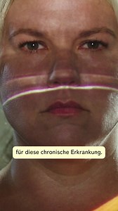 Schluss mit Vorurteilen bei Akne inversa: Es wird Zeit, die chronische Hauterkrankung ans Licht zu holen. #VomSchattenInsLicht #ShineALightOnHS | Hautwende