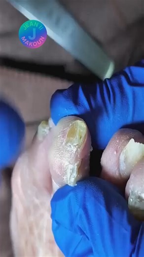 776K views · 1.1K reactions | Tips for mindful eating during office hours #WorkplaceWellness #HealthyHabits | Jean II Makoun | Facebook