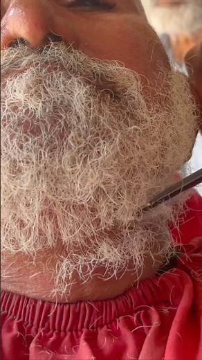 Extreme# White+ Beard Transformation | #asmr Clean & Sharp Beard #Trim ASMR