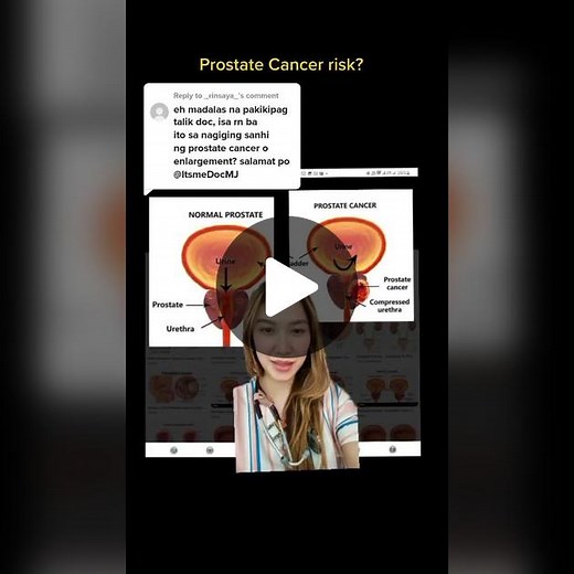 Understanding Prostate Cancer Risks: A Vital Education