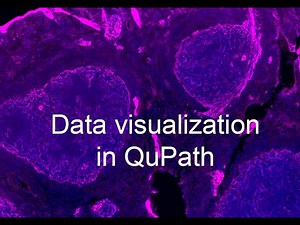 Data visualization in QuPath