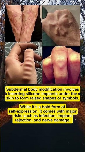 Art Beneath the Skin — The Extreme World of Subdermal Modifications