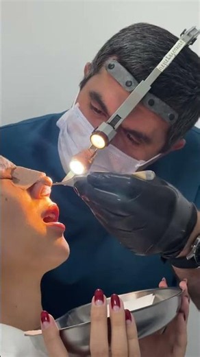 Removing splints from the nose after rhinoplasty. Taking silicone out of the nose.