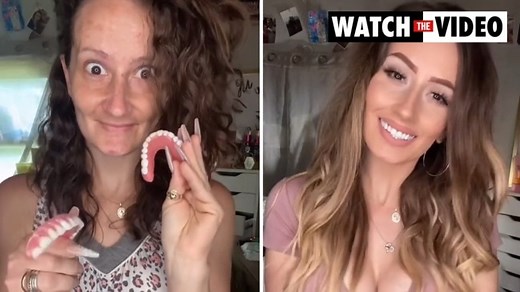 Toothless mum's jaw-dropping transformation
