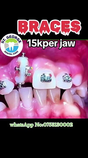 St George Dental on TikTok