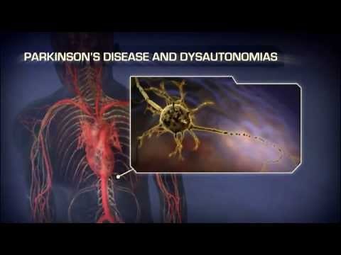 Neurogenic Orthostatic Hypotension - Medical Animation