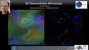 3D Deconvolution Microscopy | Canal U
