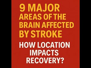 9 Major Areas of the Brain Affected by Stroke. How Location Impacts & Recovery?