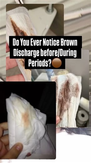SharonChronicles | 💕Comment “Brown” to Receive a Free Guideline 💕 💡 Brown Period Blood Brown blood is usually just old blood that’s taking longer to exit the... | Instagram
