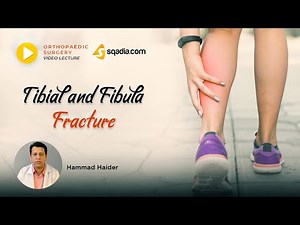 Tibial and Fibula Fracture | Lecture