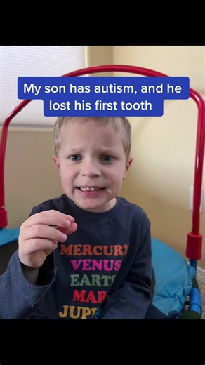Autism Awareness: My Son's First Tooth Lost Experience
