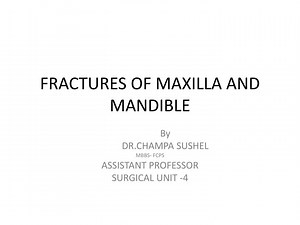 FRACTURES OF MAXILLA AND MANDIBLE - SlideServe