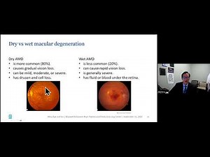 Blum Center Program: Understanding Macular Degeneration