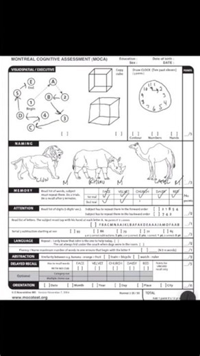 Memory Test: How Well Can You Remember?