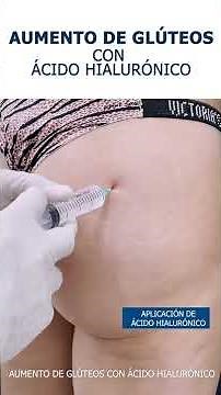 AUMENTO DE GLUTEOS CON ACIDO HIALURONICO