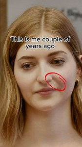 Face Fitness System If you have smile lines, nasolabial folds, sagging skin, I have developed a perfect 7-day marathon that will for only 10 minutes per day give you techniques that will relax your facial muscles and support beauty naturally. Not only that, but you’ll have access to 100 face fitness, body, and mind practices, like-minded community, and my personal guidance! Learn more through the link in my bio💛 #facetransformation #facefitness #smilelines #nasolabialfolds #glowup Disclaimer: n