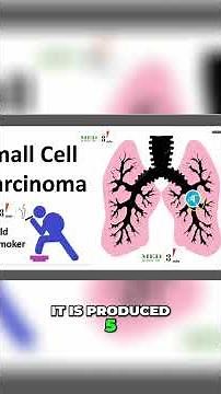 SIADH: Causes, Symptoms, and Treatments Explained #shorts