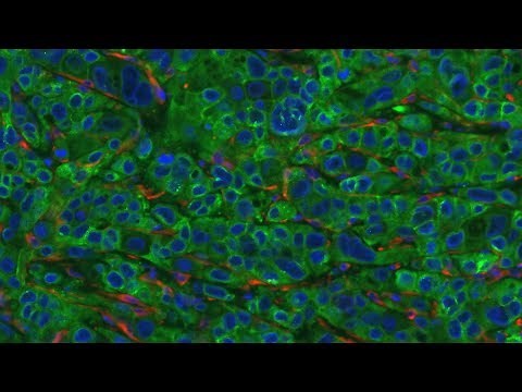 Advances in Modeling Cancer in Mice: Technology, Biology, and Beyond