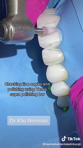 haymarketDentalEdinburgh on TikTok