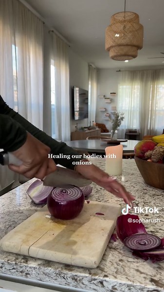 Healing Benefits of Onions for Holistic Wellness