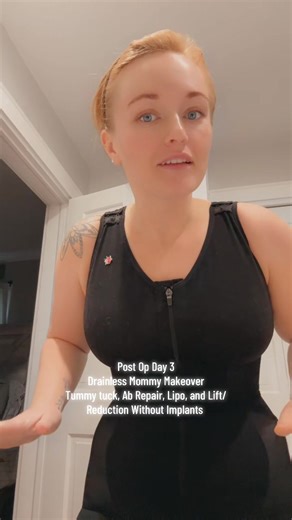 Post Op Day 3: Drainless Mommy Makeover Journey