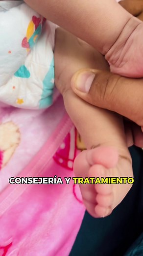 Pie Bot, Pie Zambo, Pie equinovaro Aducto, o Talipes equinovarus. #piebot #piebotbilateral #talipesequinovarus #piezambo #ortopediainfantil