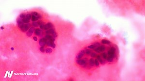 18K views · 365 reactions | Oxidized cholesterol (concentrated in...