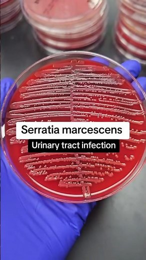 Serratia marcescens | Prodigiosin pigment
