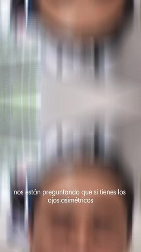 Cirugía para Ojos Asimétricos: Todo Lo Que Debes Saber