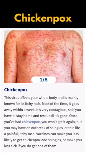 Skin Infections: What You Should Know#skincare#dermatology