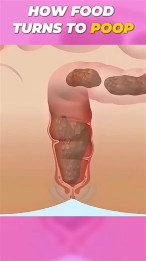 How Food Becomes Poop 💩 | Digestive System Explained. Ever wondered what happens to your food after you eat it? 🍎🥩 Follow the journey from bite to… well, poop! Learn the digestive process in 60 seconds. 🕒 #DigestiveSystem#poop#ScienceExplained#fyp#creatorsearchinsights