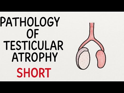 Testicular Atrophy Pathology | Short & Simple Revision for Nursing Students