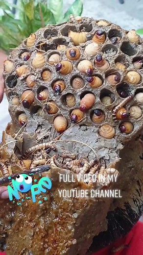 Largest Dandruff Flake Discovery | Doctor Flakes Revealed!