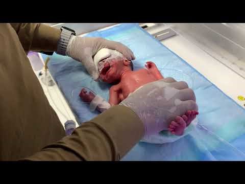 Cute LBW Baby First Physiotherapy | Gentle NICU Care Moments👶💖 #LBWBaby #NICUBaby #BabyPhysiotherapy