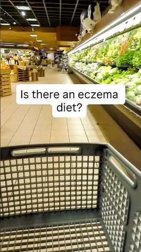 Foods to eat and limit with eczema.