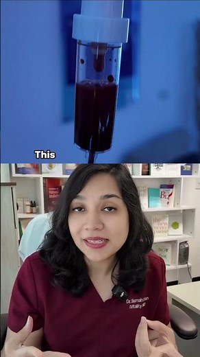 What is IV Ozone therapy?