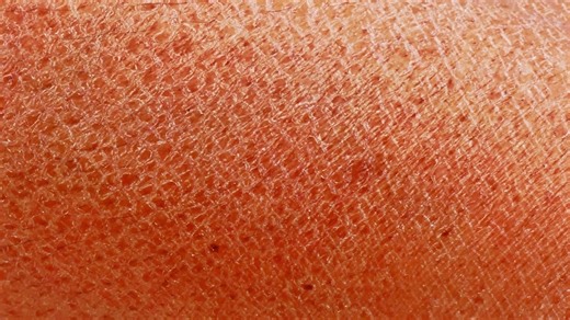First map of human skin ready. It could forever change dermatology