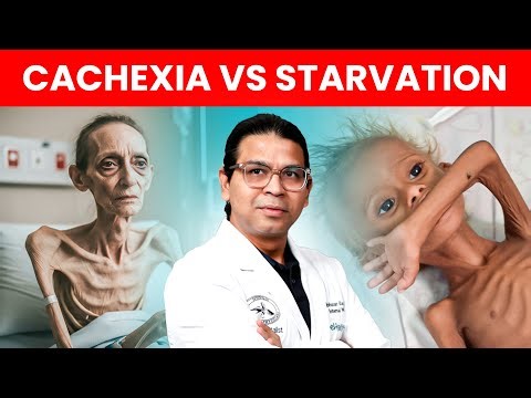 Cancer Cachexia vs Starvation | Why Cancer Cachexia Is Not the Same as Starvation?